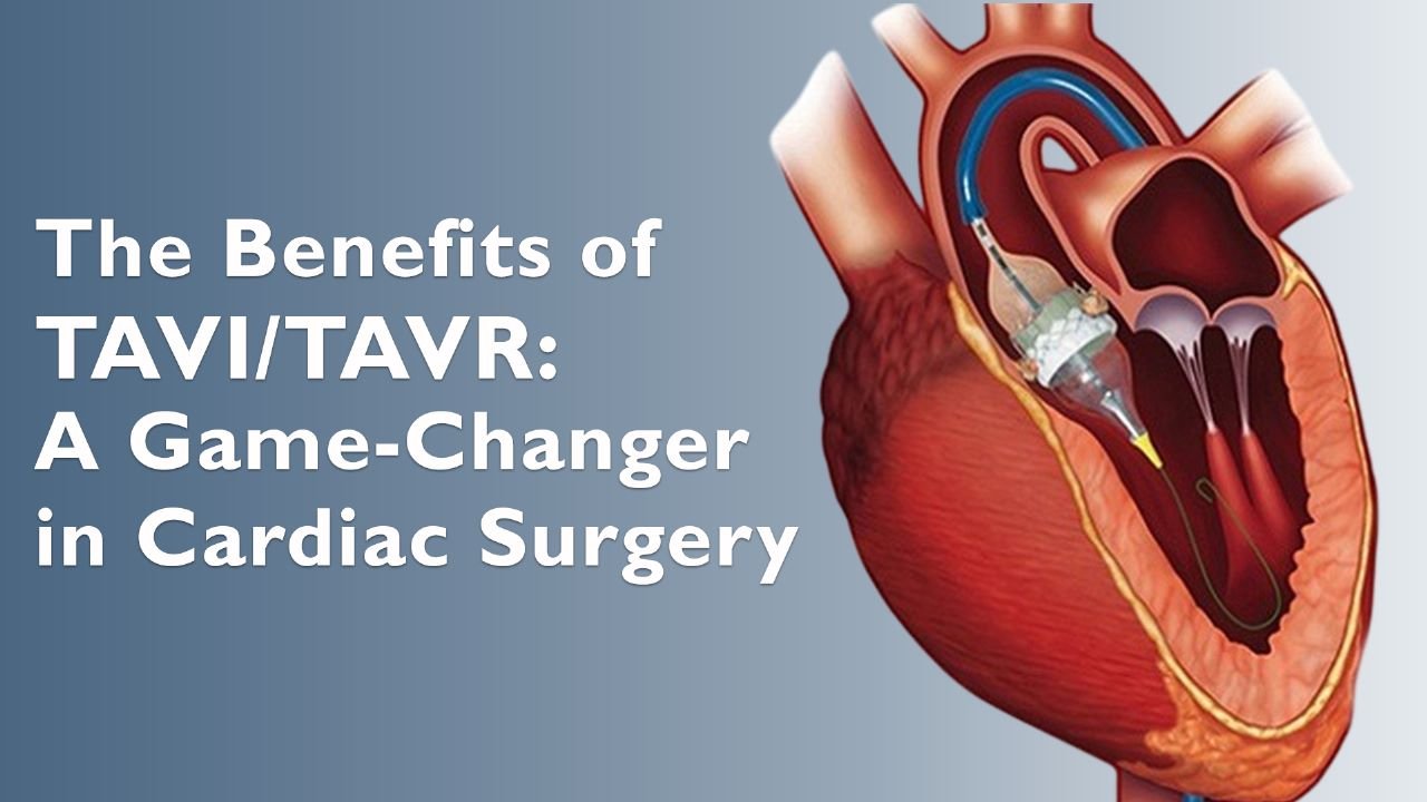 Coronary Angiography (CAG)